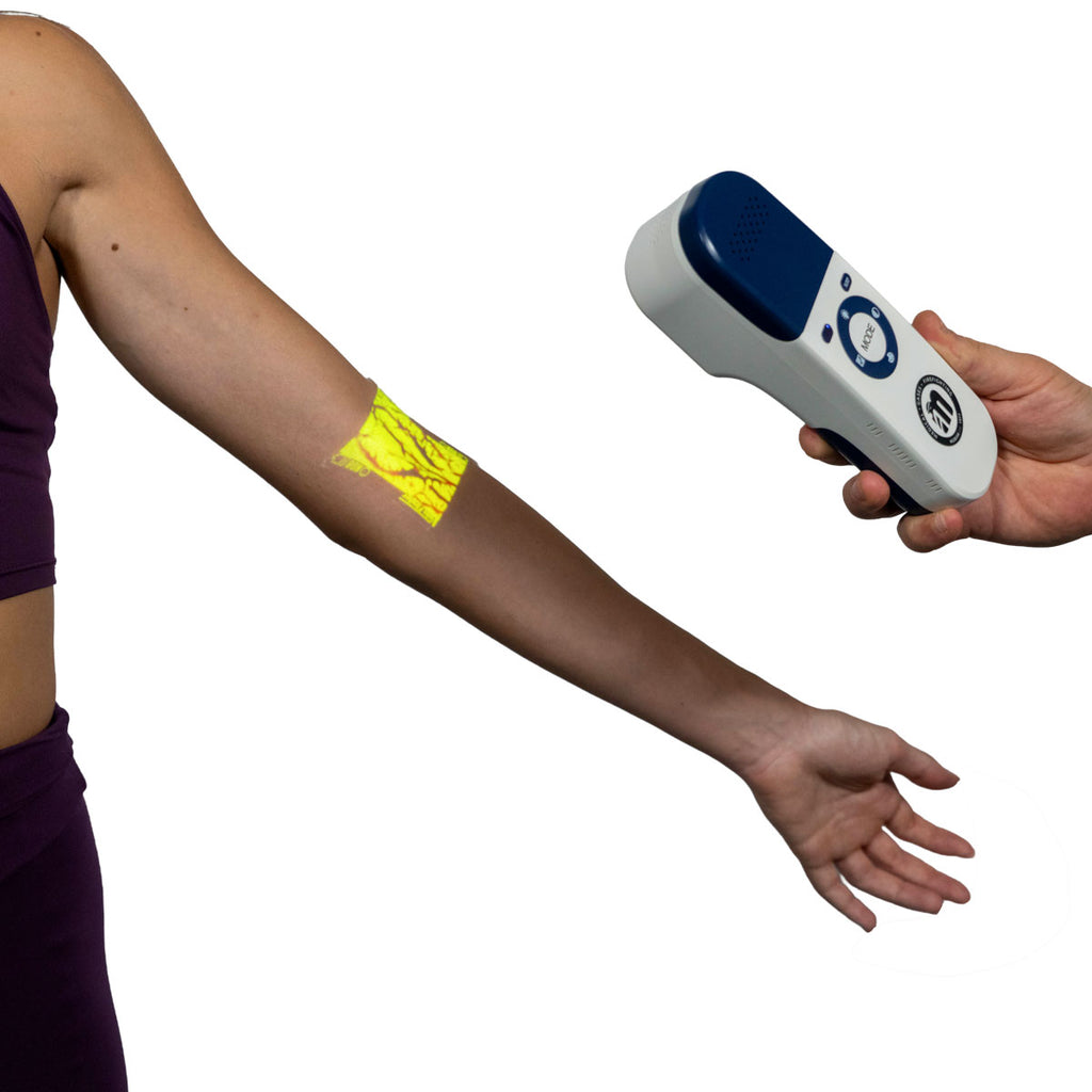 Portable Vein Finder