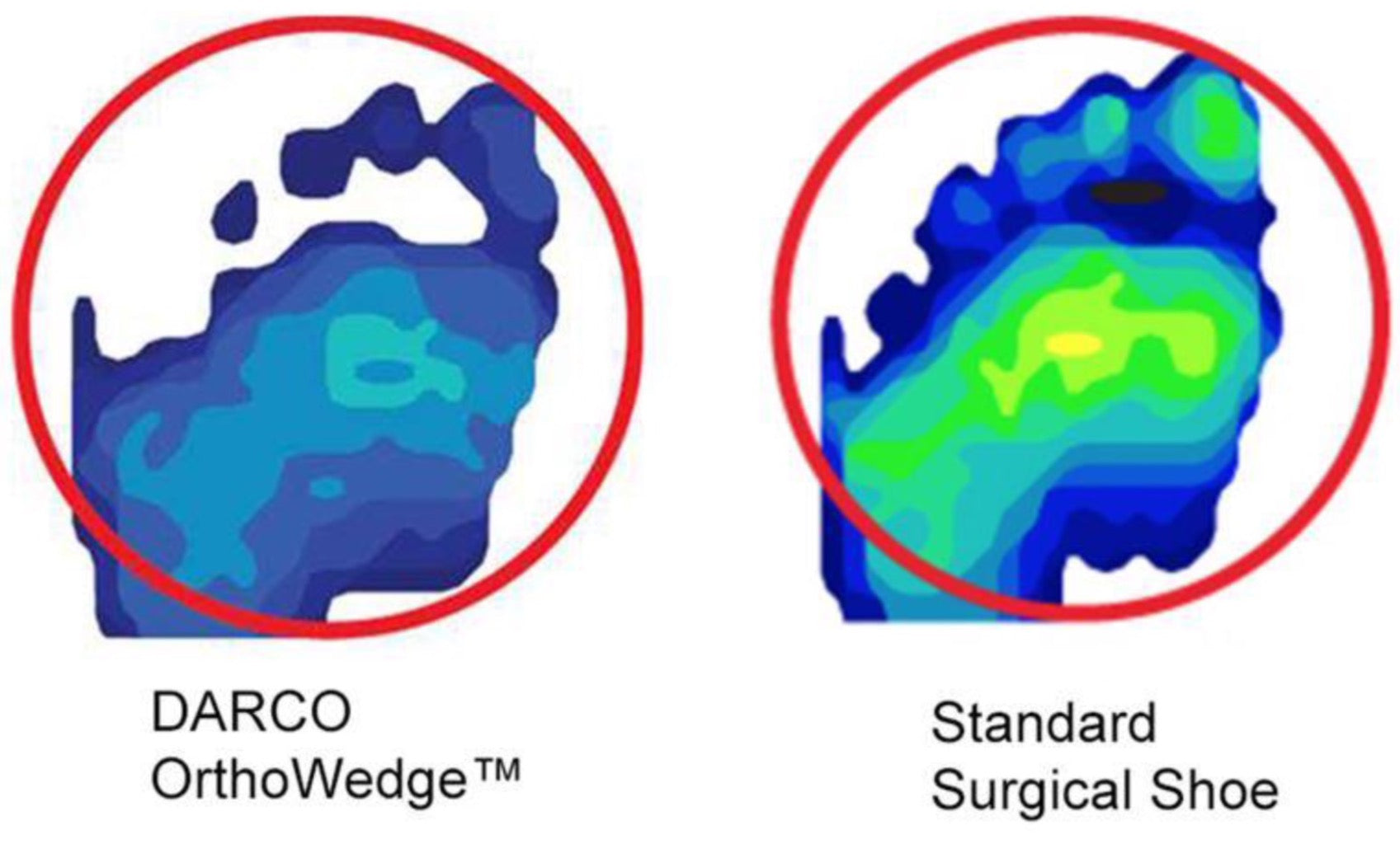 DARCO OrthoWedge shoe sole