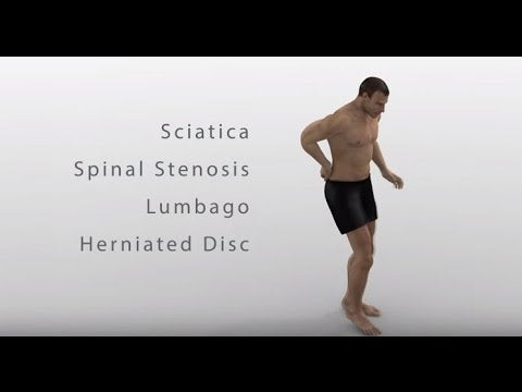 Vertetrac – The answer for Back Pain (Meditrac video)
