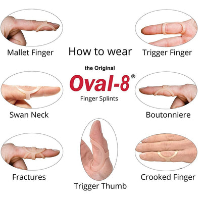 OVAL-8 FINGER SPLINT