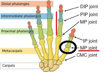 11 FINGER KNUCKLE BENDER SPLINT