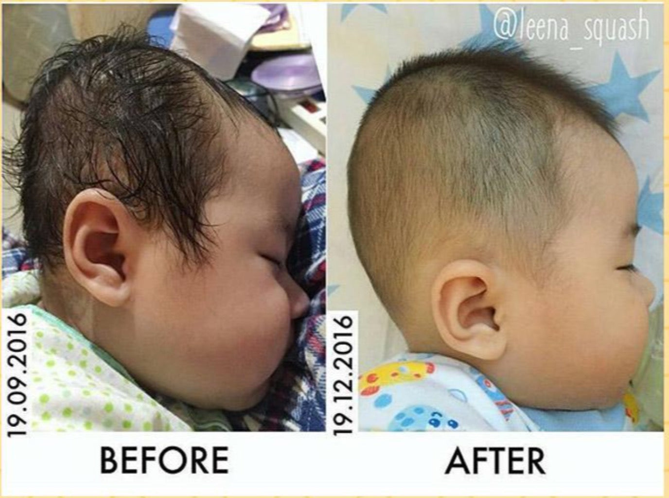 MIMOS BREATHABLE PILLOW